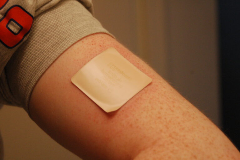 A person having a transdermal patch on his arm